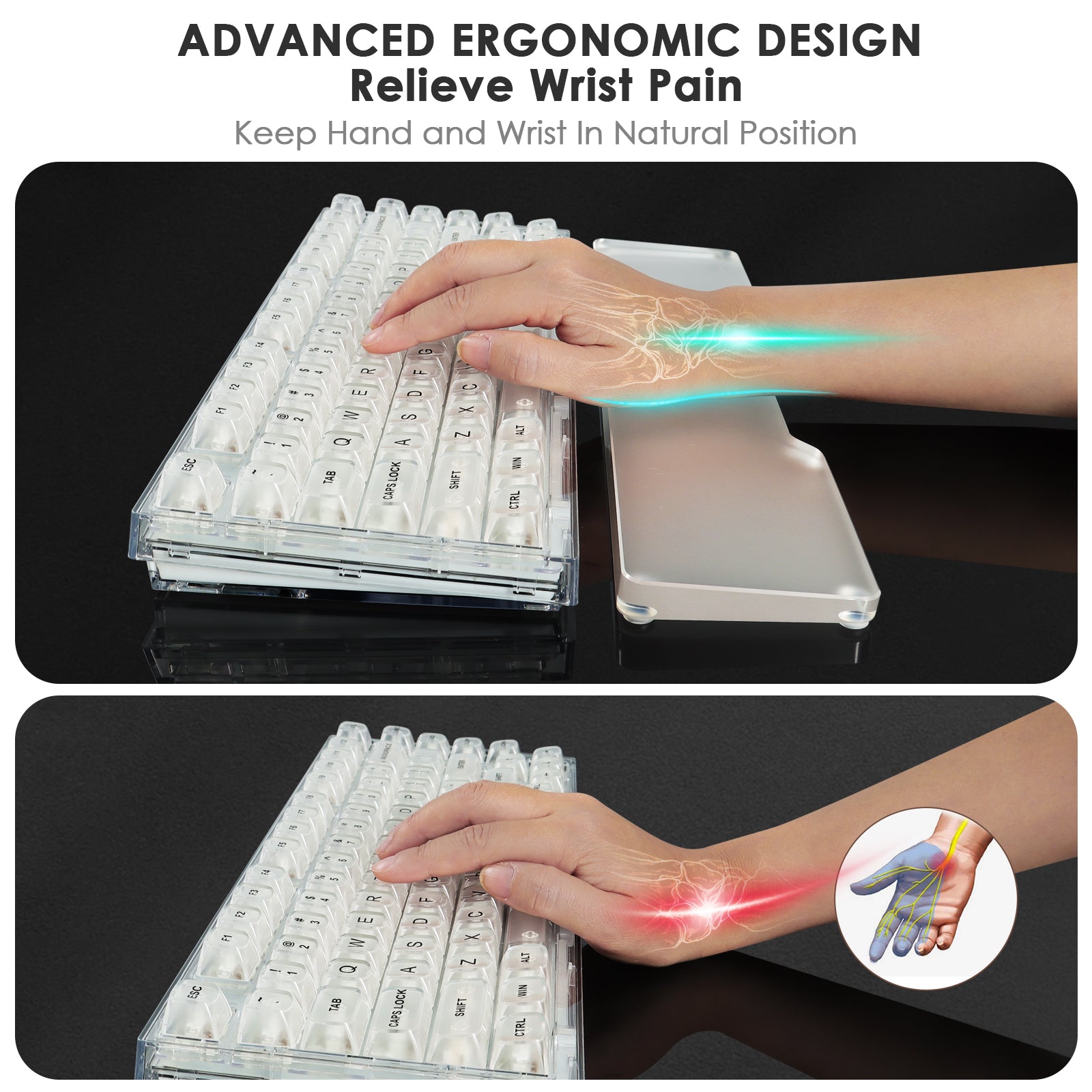 Ergonomic wrist rest demonstrating natural hand position to relieve wrist pain.